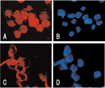 処理したU266 細胞のNFκBの局在を免疫化学染色で解析した。NFκB の核内移行が阻害
