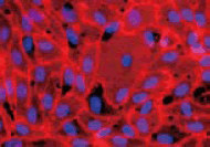 CD31抗原で染色したHUVEC細胞