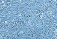 HUVEC細胞の位相差顕微鏡による画像
