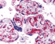 抗HIF-1α抗体を用いた胎盤絨毛の免疫染色