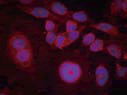 抗STAT3（pSer727）抗体（#11046）を用いた（赤色）、メタノール固定HeLa 細胞の免疫蛍光染色画像