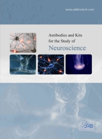Signalway Antibody社 「Neuroscienceミニカタログミニカタログ」