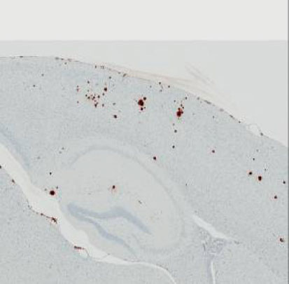 APP Tg2576トランスジェニックマウスの脳組織。抗体：抗β-アミロイド（1-40）抗体