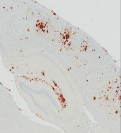 APP Tg2576トランスジェニックマウスの脳組織。抗体：抗β-アミロイド（1-42）抗体