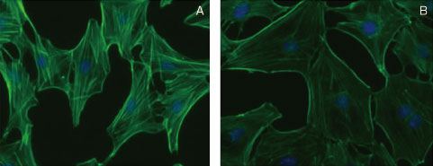 Rhoの活性化とアクチン細胞骨格の構造変化