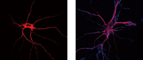 マウス海馬神経細胞組織の蛍光免疫染色