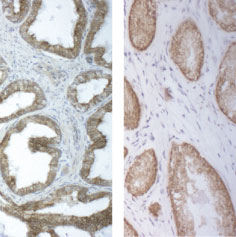 抗サイトケラチン18抗体（クローンM5）を用いたヒト前立腺組織の染色像
