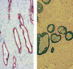 抗サイトケラチン18抗体（クローンM6）を用いたヒト前立腺組織の染色像