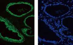 抗サイトケラチン18抗体（クローンM6）を用いたヒト前立腺組織の染色像