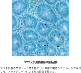 マウス乳がん組織の染色像