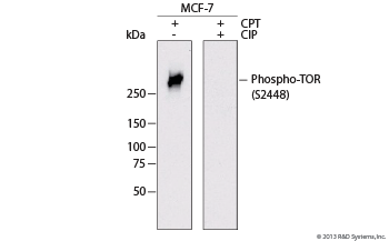 Human Phospho-TOR (S2448) Monoclonal Antibody 