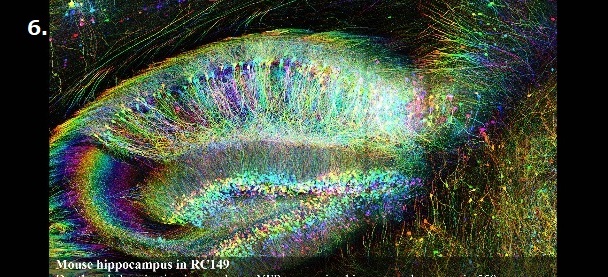 Mouse hippocampus in RC149