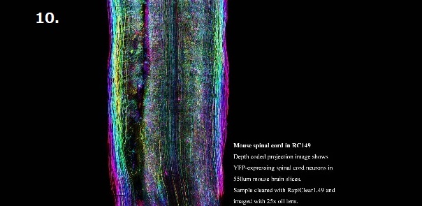 Mouse spinal cord in RC149