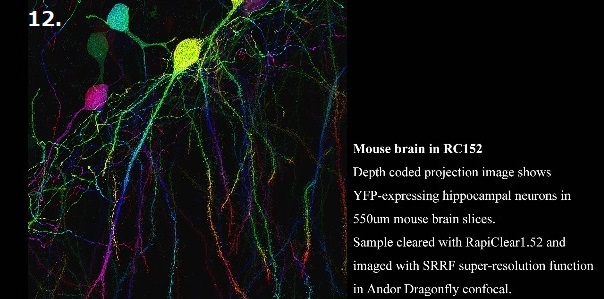 Mouse brain in RC152