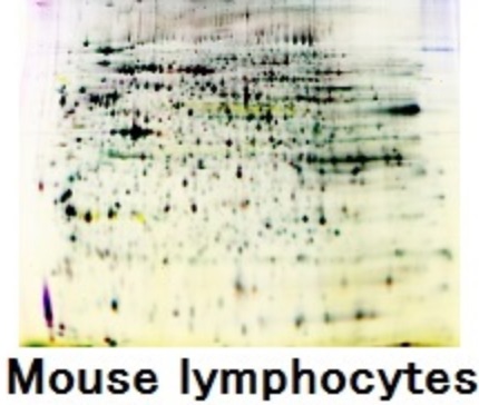 Mouse_lymphocytes