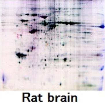 Rat_brain