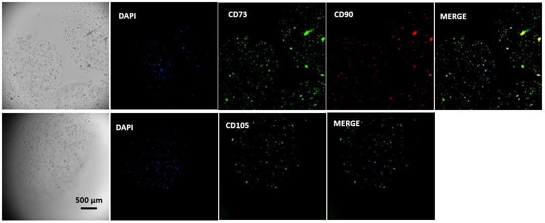  VitroGel MSCから形成したハイドロゲルビーズで培養したMSCの免疫蛍光染色像