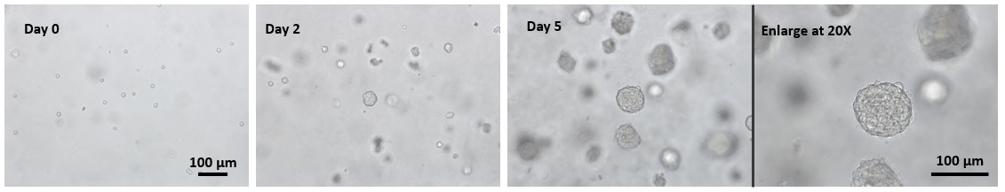  VitroGel HEK293を用いた細胞スフェロイドの継代培養