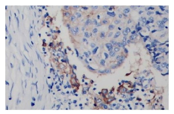 抗PD-L1抗体（#ARG65862）を用いた免疫組織染色像