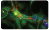 神経前駆細胞用培地