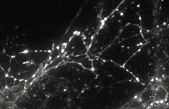 神経細胞トレーサーFFN