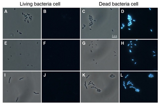 各種細菌の培養液中にAIE Bacterial (Dead) （100 μM）を添加30分後の明視野像および蛍光顕微鏡画像