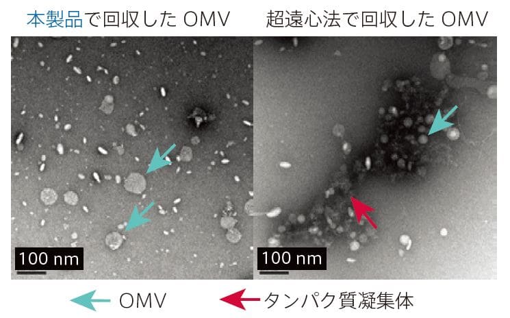 グラム陰性菌の外膜小胞を単離するキットExoBacteria OMV Isolation Kit