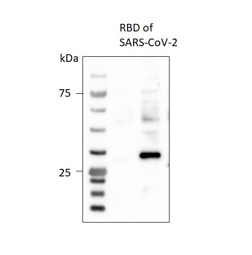 新型コロナウイルスのACE2タンパク質受容体結合ドメイン（RBD)の発現例