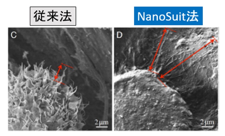 NanoSuit黒色腫比較