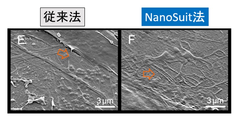 NanoSuit線維芽細胞比較