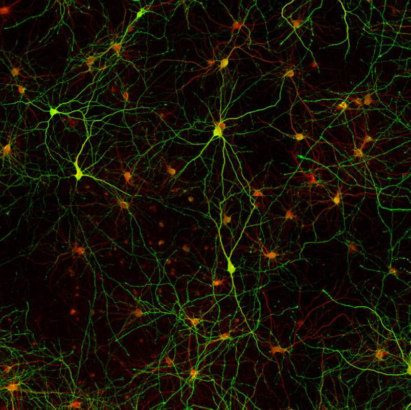 抗GABA抗体を用いたラット初代皮質ニューロンの免疫染色画像