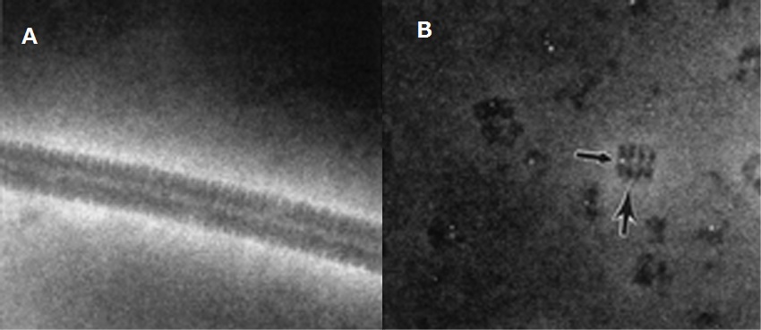 NanoVan電子顕微鏡像