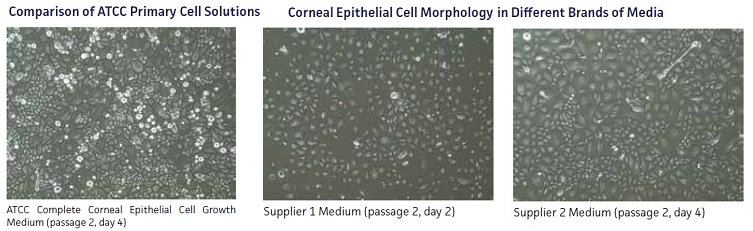 Primary Corneal Epithelial Cell#PCS-700-010の写真