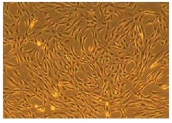 Mesenchymal Stem Cell培養例1