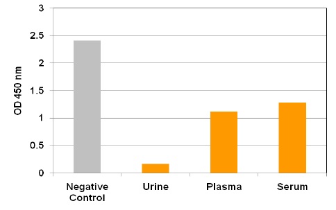 ヒト血清、血漿、尿中の5-fC測定例