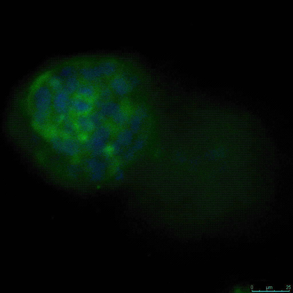 HCT116細胞の3D細胞培養のビデオ画像E