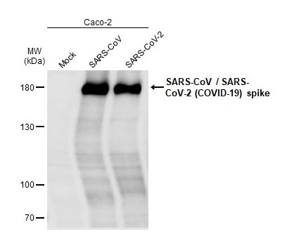 Anti-SARS-CoV-2 (#GTX632604) WB像
