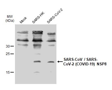 Anti-SARS-CoV-2 (#GTX632696) WB像