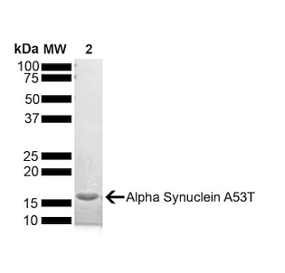 Amyloid β Fibril (OC) / Oligomer (A11) Antibody