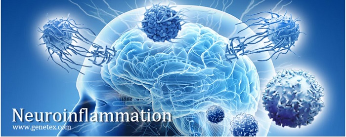 神経炎症（Neuroinflammation）イメージ画像