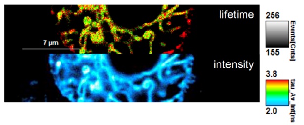ER Flipper-TR染色したHeLa細胞の蛍光寿命イメージング顕微鏡像