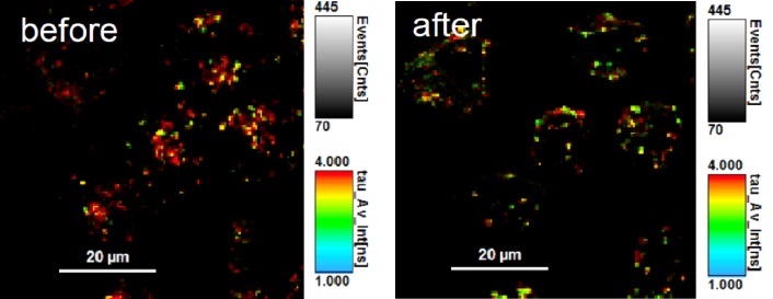 Lyso Flipper-TR染色したHeLa細胞の蛍光寿命イメージング顕微鏡像