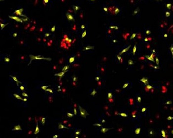 CytoFlammaシリーズで染色したHeLa細胞の蛍光染色画像