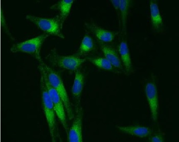 MytoFlamma Greenで染色したHeLa細胞の蛍光染色画像