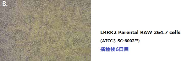 LRRK2 Parental RAW 264.7 cells