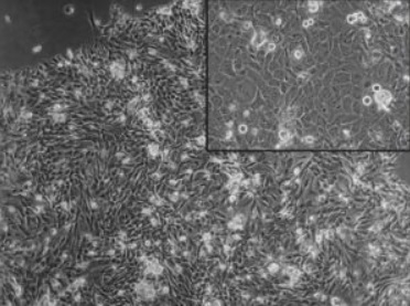 接着増殖パターンを示す扁平上皮がん由来細胞の初代培養