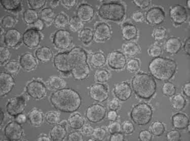 3D球体形成を伴う浮遊増殖パターンを示す悪性度の低い小細胞肺がん由来細胞の初代培養