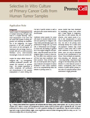 Selective In Vitro Culture of Primary Cancer Cells from Human Tumor Samples