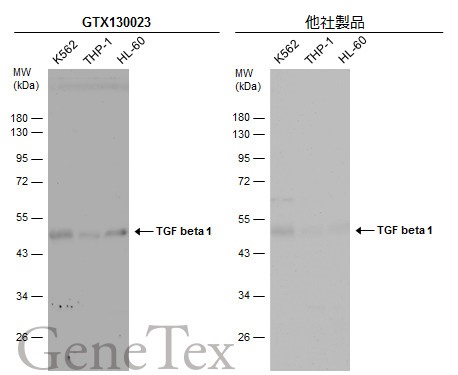 抗TGFβ1抗体を用いたウエスタンブロット像