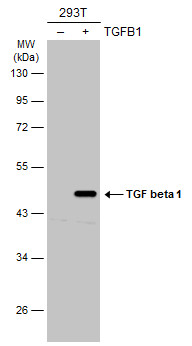 抗TGFβ1抗体を用いたウエスタンブロット像